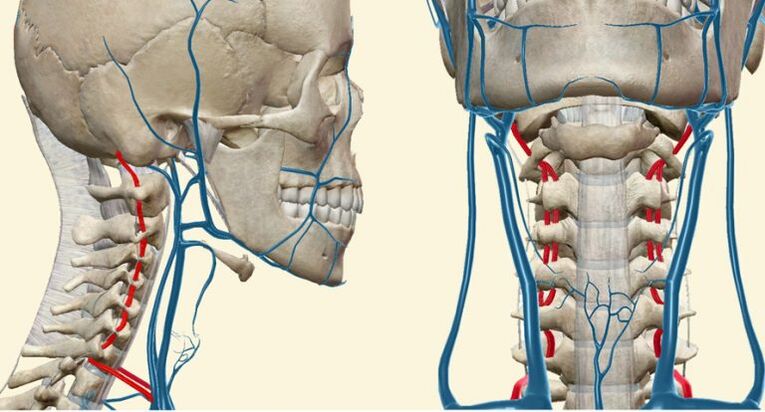 Gefäßsyndrom bei Osteochondrose