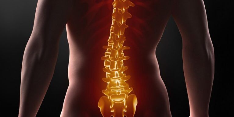 Osteochondrose der Sakralsäule