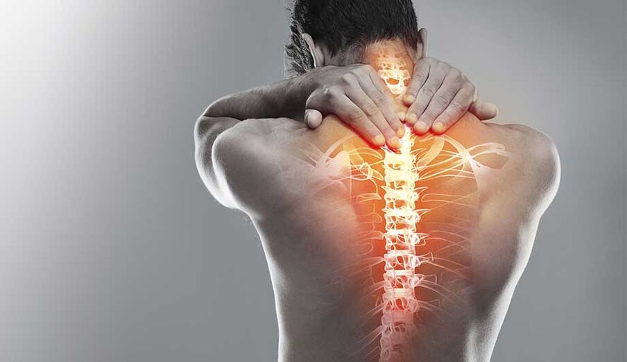 Wirbelsäulenschmerzen aufgrund von Osteochondrose